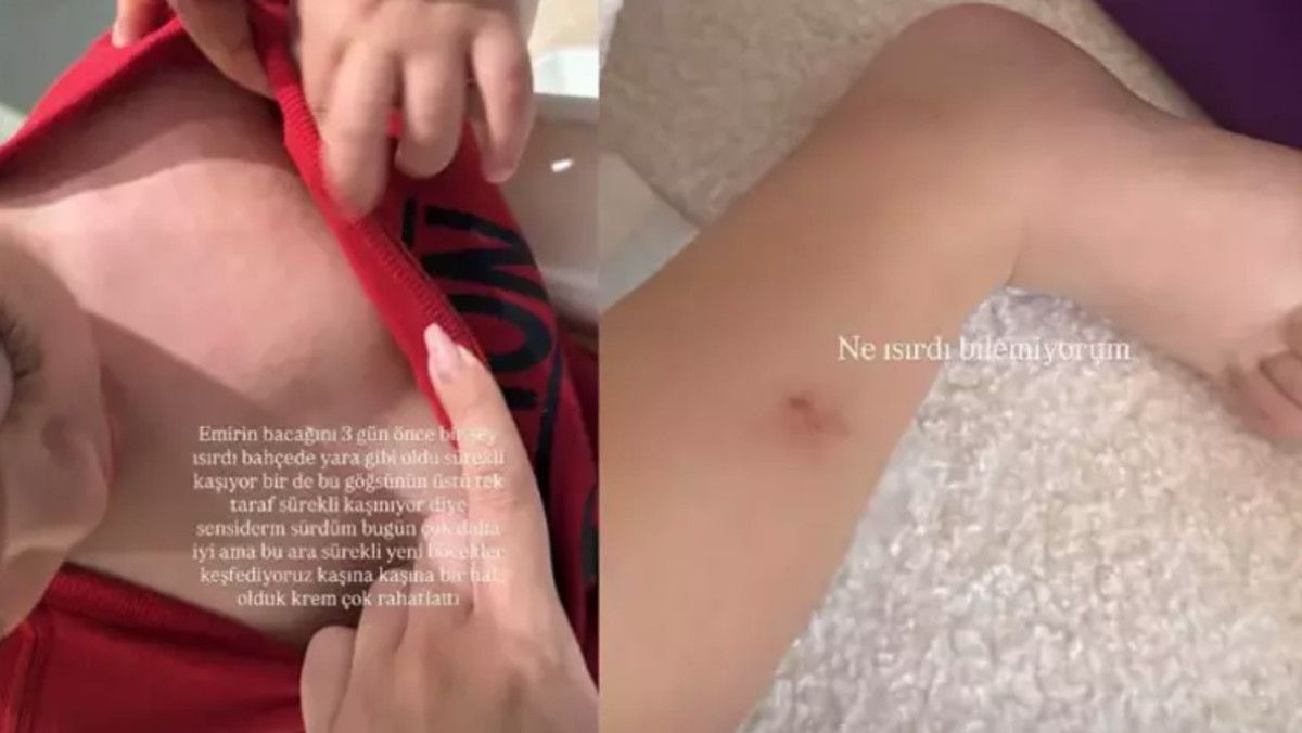İdo Tatlıses ve Yasemin Şefkatli'nin İkizleri İçin Yaşanan Gelişme: Sağlık Durumu ve Aileden Gelen Güncel Paylaşım